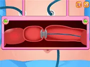 Colon Colectomy Surgery gameplay preview