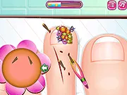 Funny Nail Doctor gameplay preview